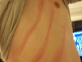Scratches 2